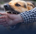 Dog Bite Attorney La Quinta