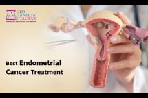 Best Endometrial Cancer Treatment in Manipal