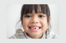 Baby Teeth Coming in Late: Understanding Delayed Eruption