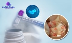 Discover the Egg Freezing Cost in Bangalore with Orchidz Health