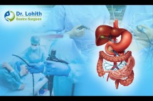 Best Surgical Gastroenterology in Bangalore