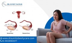 Best PCOS treatment in Bangalore - Dr. Sumit Talwar