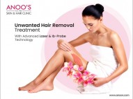 Permanent Unwanted Hair Removal Treatment at Anoos