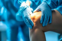 Get Back to Pain-Free Living – Consult Lancashire’s Leading Knee Specialist Bilal Barkatali