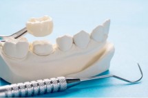 Revive Your Teeth with Arlington’s Premium Dental Crowns, Made Just for You