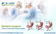 Best Bariatric Surgery in Bangalore - Dr. Lohith U