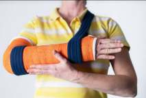 Effective Arm Compression Sleeves for Lymphedema Relief