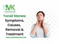 Popping Hidden Tonsil Stones - What Causes Tonsil Stones?