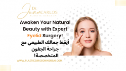 Eyelid surgery in Dubai | Dr Juan