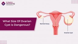 What size of ovarian cyst is dangerous